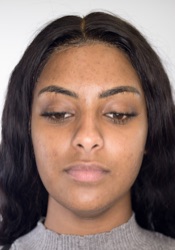 After treatment: example one