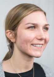 After treatment: example two