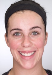 After treatment: example three