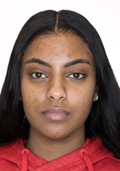 Before treatment: example one