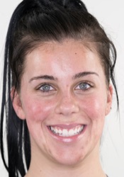 Before treatment: example three